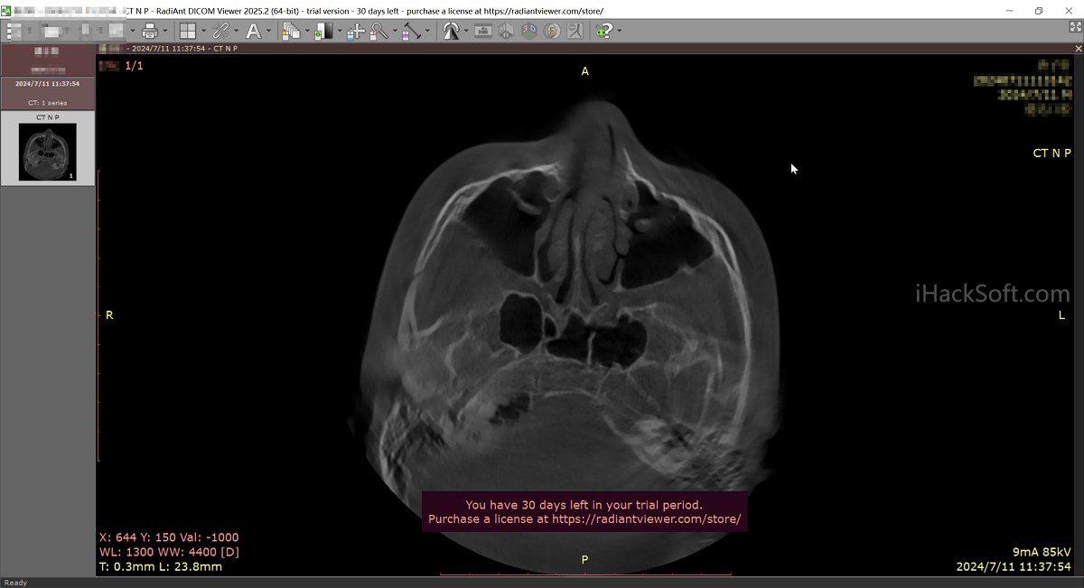 RadiAnt DICOM Viewer