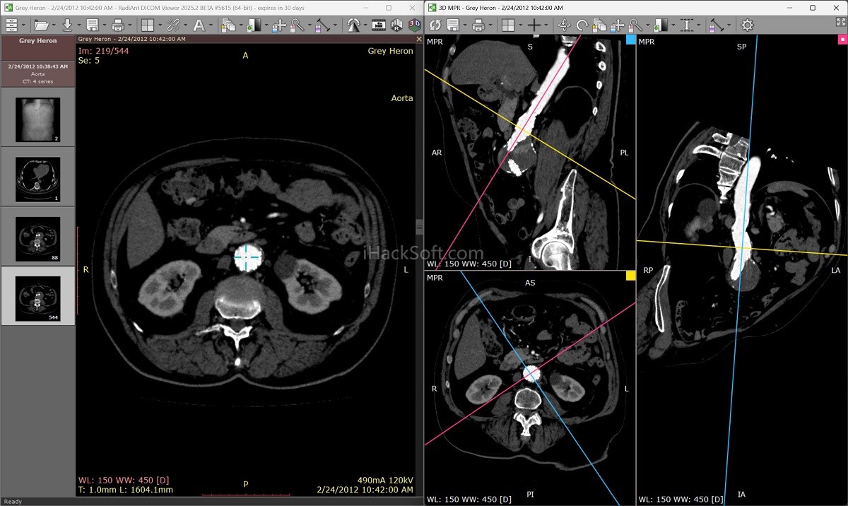 RadiAnt DICOM Viewer